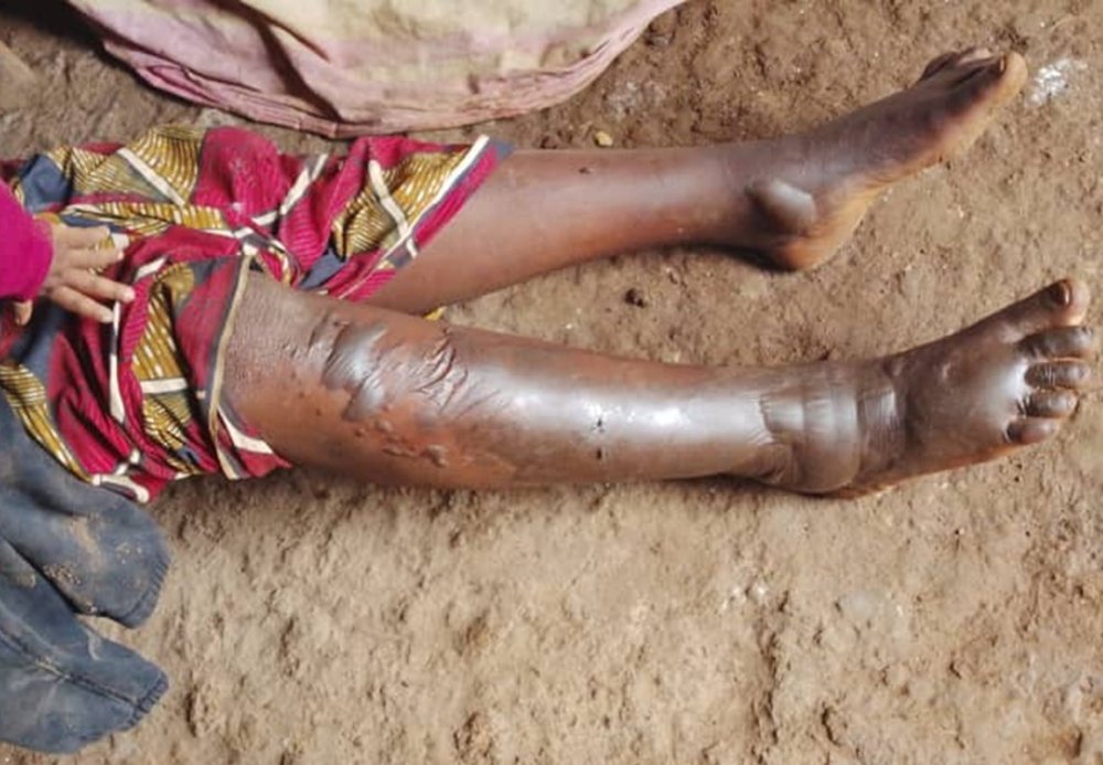 Rusizi: Yatawe muri yombi nyuma yo gutwikisha umugore we amavuta yatuye