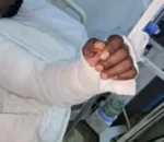 Ntibisanzwe! Umusore wo muri Ethiopia yacitse ukuboko, abaganga bagusubizaho neza