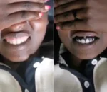 Ibyago ku bishyiraho “tattoo” ihindura ishinya umukara