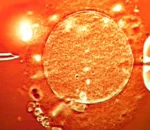 Intanga z’umuterankunga wari ufite “gene” itera kanseri zakoreshejwe mu kubyara abana hafi 200