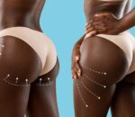 Nigeria: Umukobwa yishwe no kwibagisha ikibuno