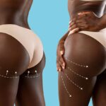 Nigeria: Umukobwa yishwe no kwibagisha ikibuno