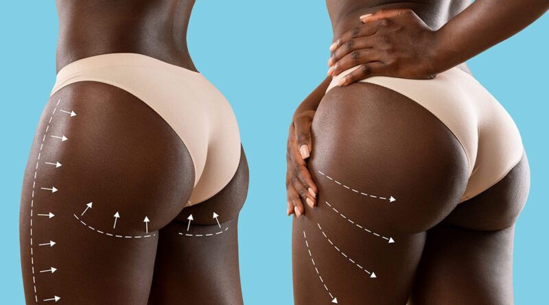 Nigeria: Umukobwa yishwe no kwibagisha ikibuno