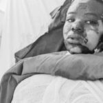 Ngororero: Umuganga yatwikishije amazi ashyushye umukozi we wo mu rugo