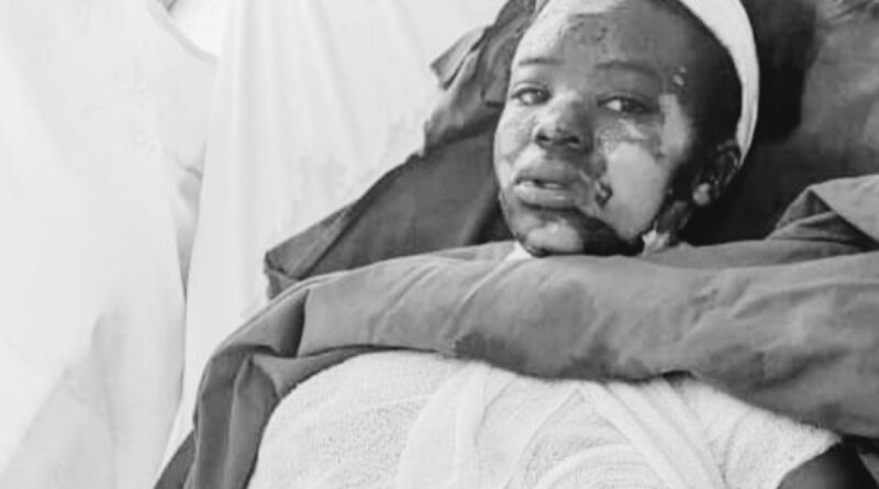 Ngororero: Umuganga yatwikishije amazi ashyushye umukozi we wo mu rugo