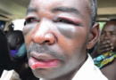 Bugesera: Umugabo yarumye umunwa w’umunyerondo arawumira