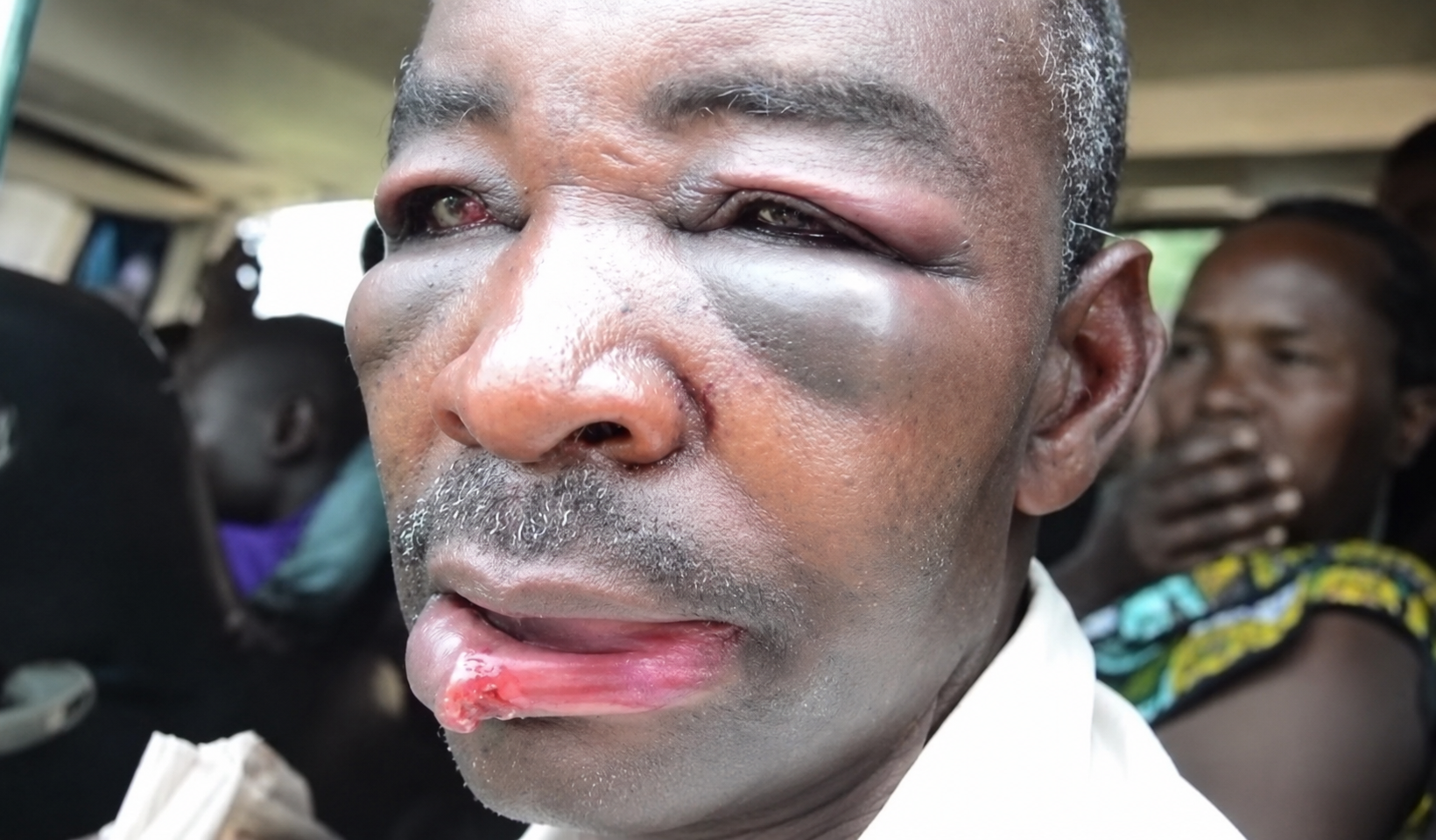 Bugesera: Umugabo yarumye umunwa w’umunyerondo arawumira