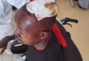 Agahinda i Bugesera: Umugabo yatemwe mu mutwe n’umujura witwaje umuhoro aranamwiba