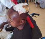 Agahinda i Bugesera: Umugabo yatemwe mu mutwe n’umujura witwaje umuhoro aranamwiba
