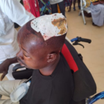 Agahinda i Bugesera: Umugabo yatemwe mu mutwe n’umujura witwaje umuhoro aranamwiba