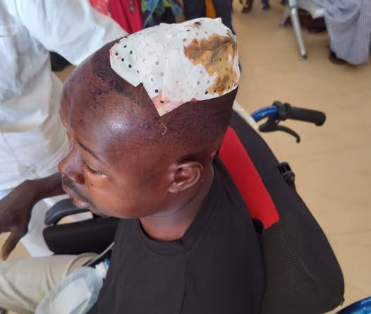 Agahinda i Bugesera: Umugabo yatemwe mu mutwe n’umujura witwaje umuhoro aranamwiba