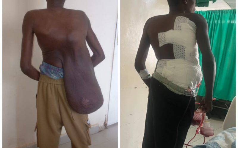 Bayiringire yakize ikibyimba kinini yari amaranye imyaka 16.